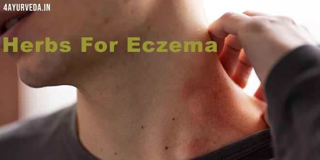 Herbs for eczema