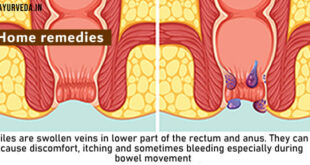Home remedies for Piles