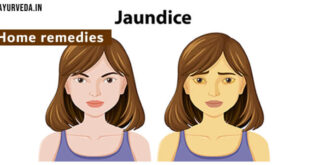 Home remedies for heaptitis