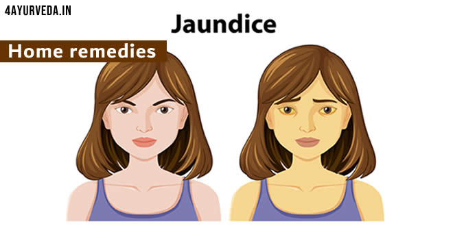 Home remedies for heaptitis